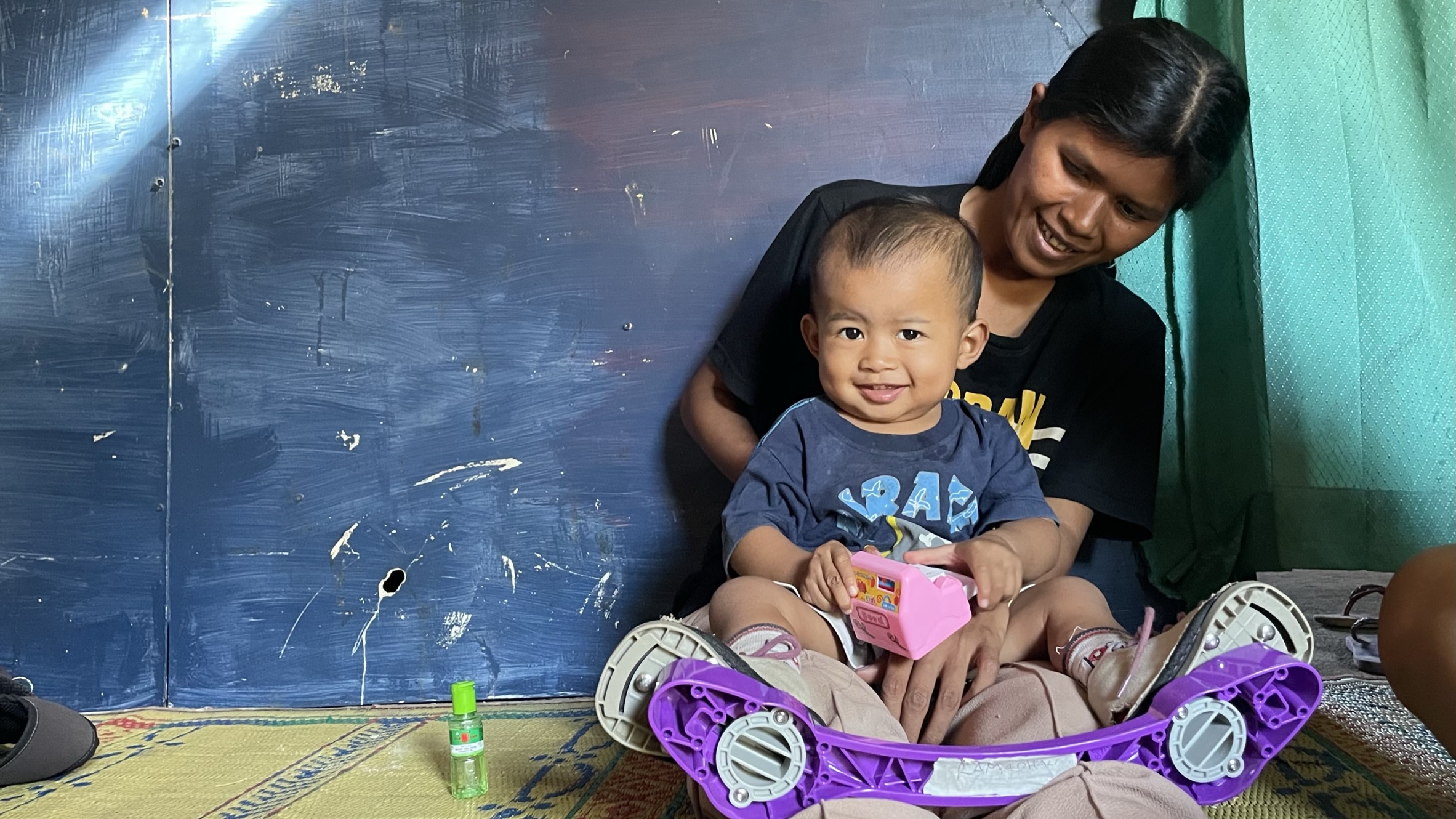 Program Pendampingan Penanganan & Brace Gratis untuk Clubfoot/CTEV